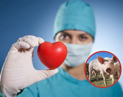 The First Successful Pig-To-Human Heart Transplant – Nutrition Center