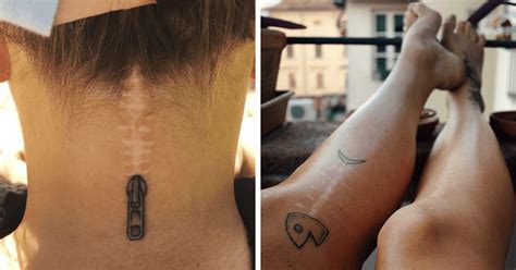 25 Beautiful Tattoos That Transformed Scars Into Artworks