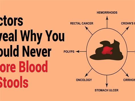 How To Check For Blood In Stool - Memberfeeling16