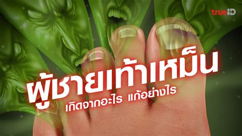 What causes smelly feet? How to cure smelly feet? What can I use? - News Directory 3