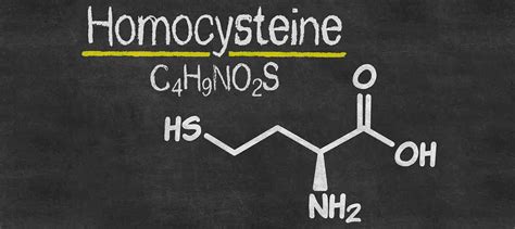 The Ideal Homocysteine Level for Cardiac Health | Dr. Stephen Sinatra