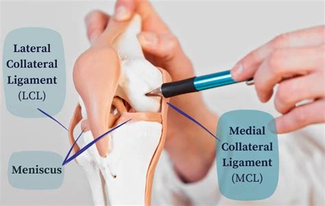 ACL Vs MCL Vs Meniscus Tear | Dr. Pamela Mehta, San Jose