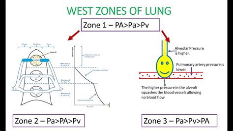 LEARN WEST LUNG ZONES EASILY /Zone 1 Zone 2 Zone 3 in lung/ lung zones anatomy /Highest ...