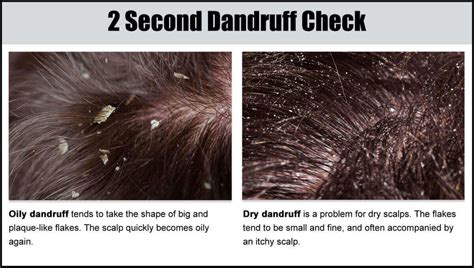 Dandrene Dandruff Shampoo And Conditioner Bundle By DS Laboratories ...