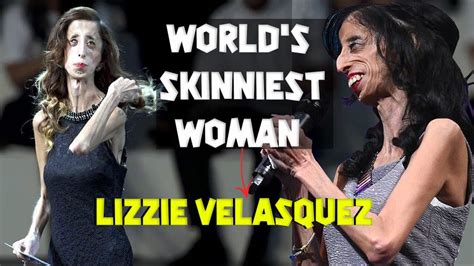 Elizabeth"Lizzie" Velásquez is an American motivational speaker and ...