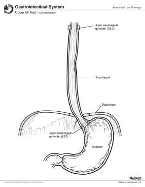 Ligament Of Treitz Diagram