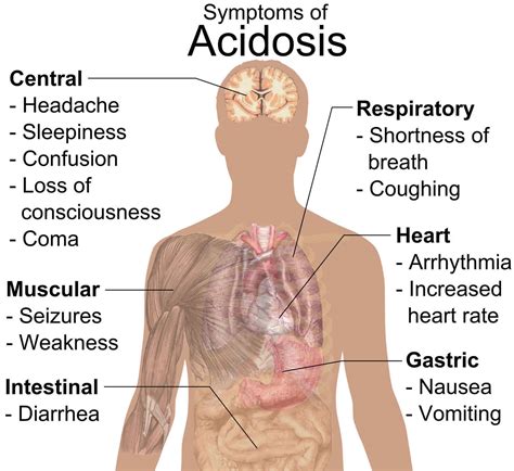 Normal anion gap metabolic acidosis or non anion gap metabolic acidosis