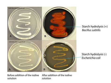 Starch Hydrolysis Test: Principle, Procedure, Results • Microbe Online