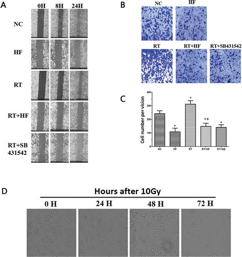 Migration and Wound healing assays. A. Wound healing assay to compare... | Download Scientific ...