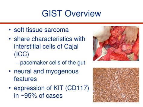 PPT - The Surgeon’s Role in the Management of Gastrointestinal Stromal ...