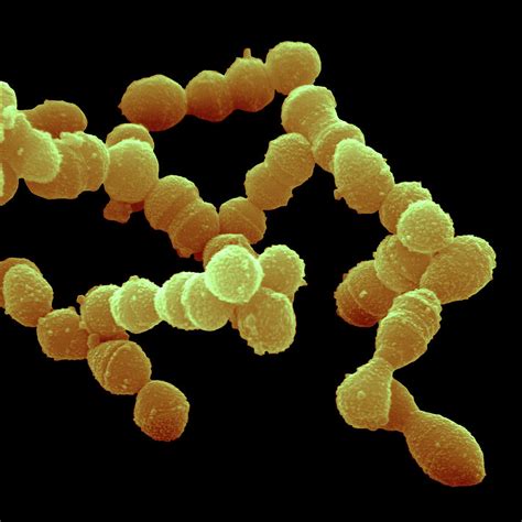 Streptococcus Pneumoniae Bacteria Photograph by Juergen Berger/science ...