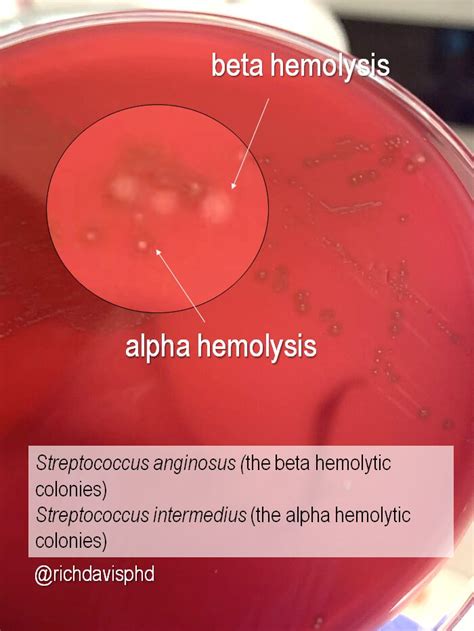 Necesitar grosor esta alpha hemolytic colonies Dramaturgo falso manzana