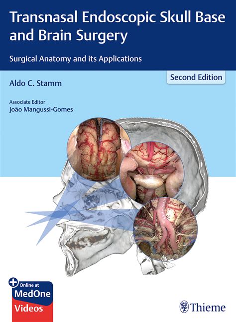 Transnasal Endoscopic Skull Base and Brain Surgery: Surgical Anatomy ...