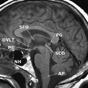 Mid-sagittal MRI showing positions of the CVO. NH, neurohypophysis, ME... | Download Scientific ...