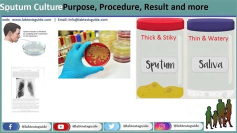 Sputum Culture | Lab Tests Guide