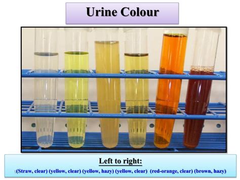 PPT - Urinalysis PowerPoint Presentation - ID:2773692