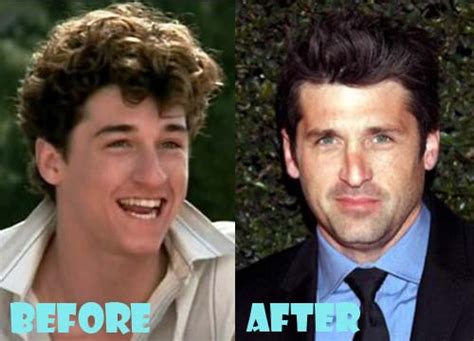 Patrick Dempsey Plastic Surgery Before and After Nose Job - Lovely Surgery