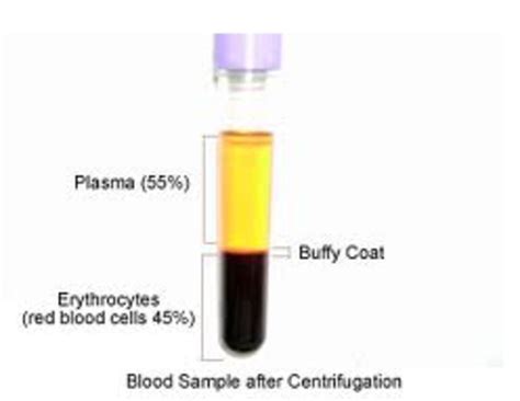 Tips on Laboratory 6 place Blood Centrifuge Machine - HubPages