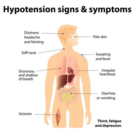 10 Ways to Treat Sudden Low Blood Pressure - Suzy Cohen, RPh offers ...