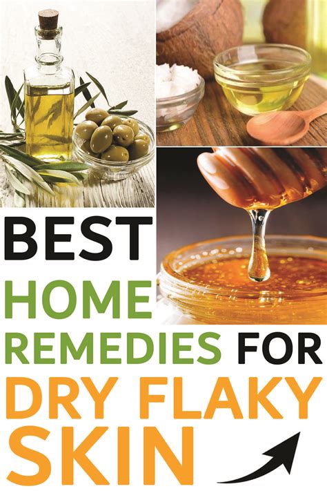 Best Home Remedies for Dry Flaky Skin in 2021 | Dry flaky skin, Flaky skin, Home remedies