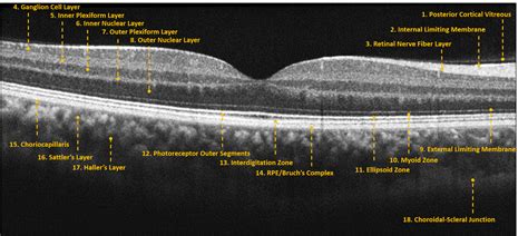 What Does A Normal OCT Look Like? | Eyes On Eyecare