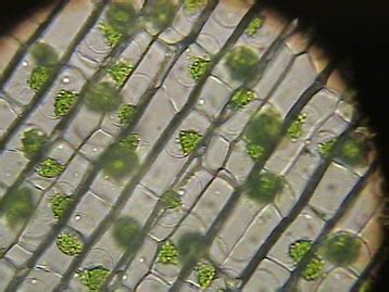 Plasmolysis