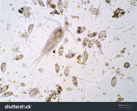 Freshwater Aquatic Plankton Under Microscope View Stock Photo 594527717 ...