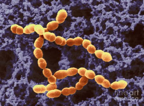 Lactobacillus Bulgaricus And Streptococcus Thermophilus