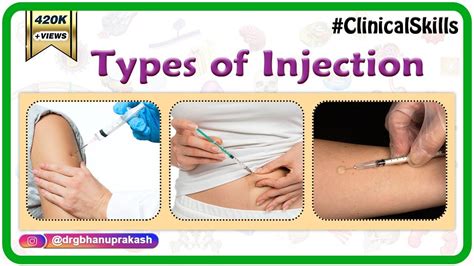 Subcutaneous Injection