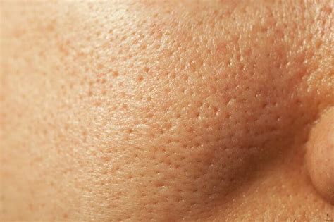 Extremely Large Pores: Causes & How to Minimize - Skin Care Geeks