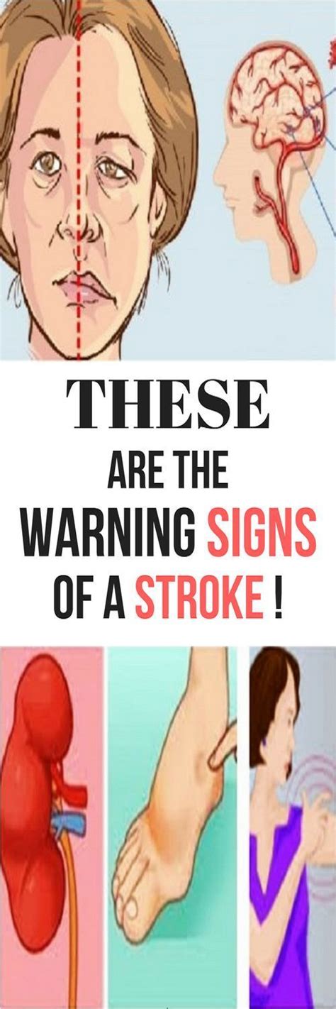 5 EARLY WARNING SINGS OF A STROKE YOU SHOULD NEVER IGNORE! - HEALTH RECIPES