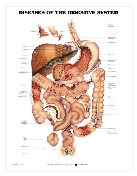 Diseases of the Digestive System — Massage Therapy Supply Outlet Ltd