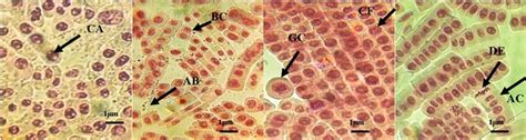 Anomalies observed in Allium cepa L. meristematic cells under light ...