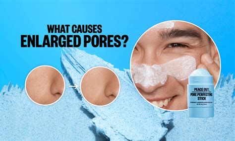 What Causes Enlarged Pores & How to Treat Them | Peace Out Skincare