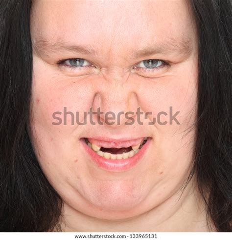 Portrait Ugly Woman Missing Teeth Stock Photo 133965131 | Shutterstock