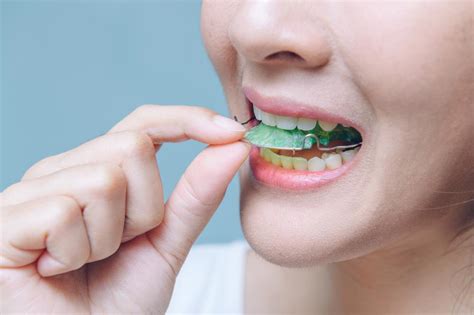 Proper Ways to Care For and Clean Your Invisalign Retainer - Trendipia