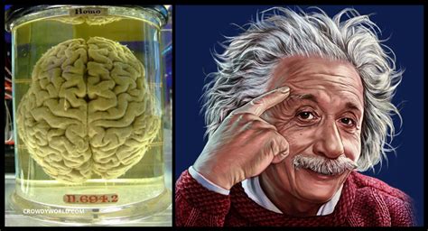 Albert Einsteins Brain On Display