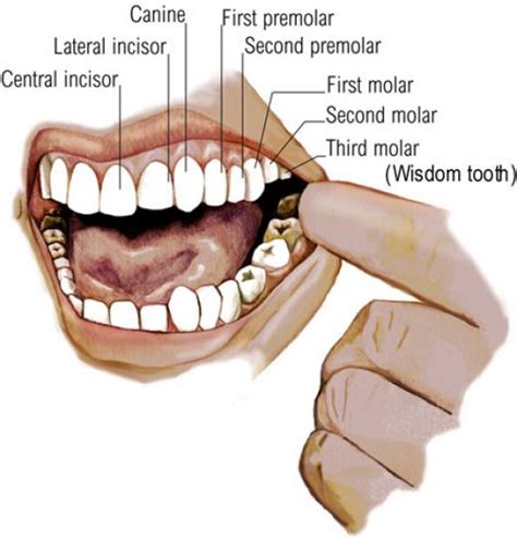 Why you may need to extract teeth | Andy Tom's Nice Blog List