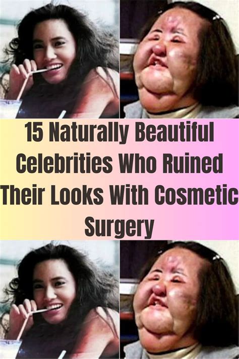 15 Naturally Beautiful Celebrities Who Ruined Their Looks With Cosmetic ...