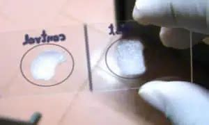 Coagulase Test - Laboratoryinfo.com