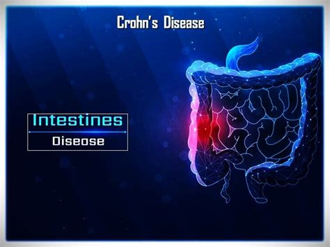 Crohn's Disease Symptoms, Causes & Treatment | Dr. Datta Ram