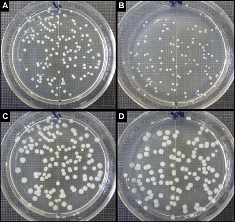 Agar Plate Bacteria