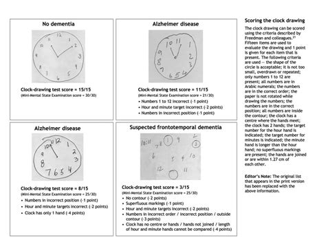 Moca Scoring Nuances With Clock Draw : Association Of Digital Clock Drawing With Pet Amyloid And ...