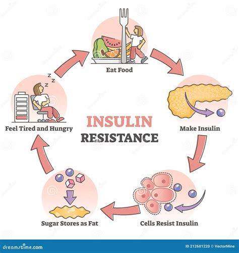 Insulin And Insulin Resistance, Educational Sheet Royalty-Free Stock ...