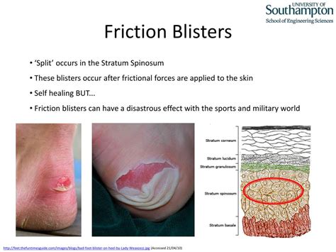 PPT - Some Aspects of Skin Tribology : Friction Blister PowerPoint Presentation - ID:1842069