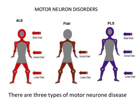 motor neuron disease ,symptoms,diagnosis,treatment