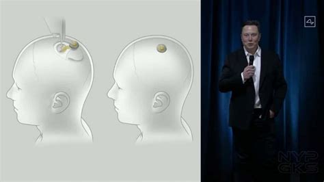 Neuralink brain implant prototype demoed by founder Elon Musk | NoypiGeeks