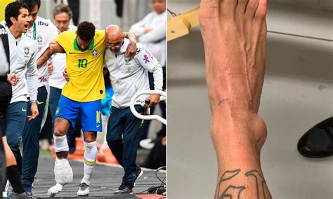 Neymar Ruled Out Of Copa America With Ankle Injury (Photos) - Mandy News