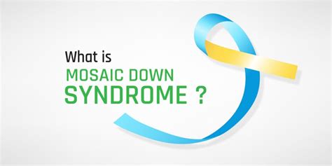 Mosaic Down Syndrome: Causes, Symptoms, Diagnosis, And Treatment