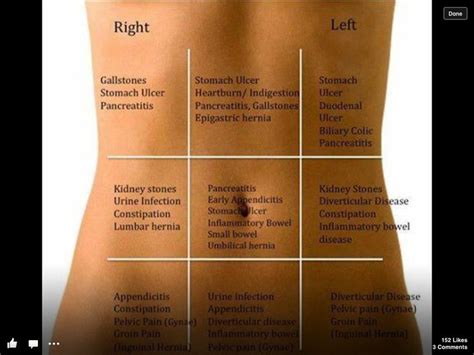 Stomach pain quick guide. The common areas of pain and what areas they ...